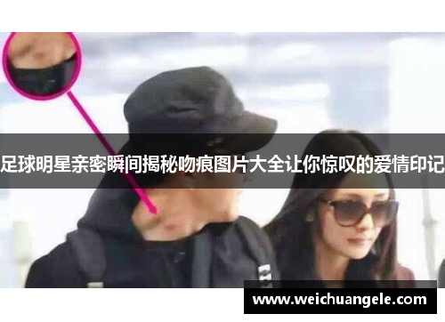 足球明星亲密瞬间揭秘吻痕图片大全让你惊叹的爱情印记